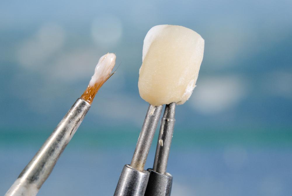 close up of dental crown