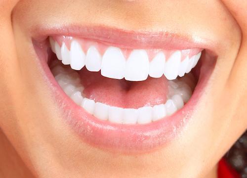 close up of woman's bright smile with teeth whitening