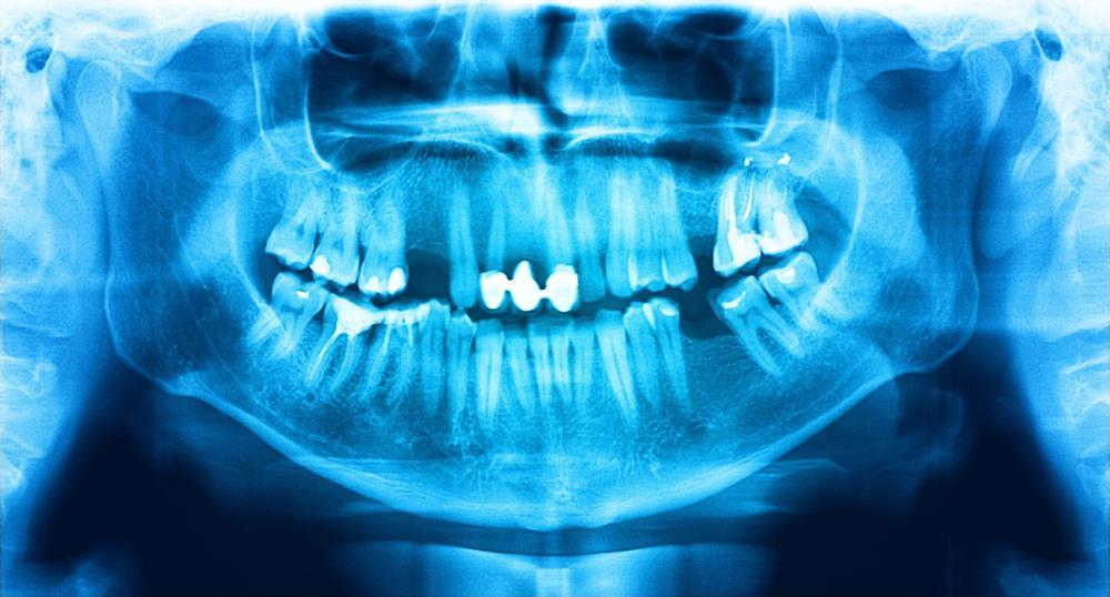 dental xray 