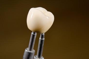 picture of dental crown