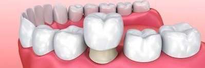 mount waverley dentist