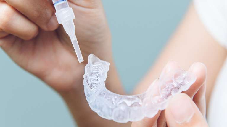 how often should you get teeth whitened