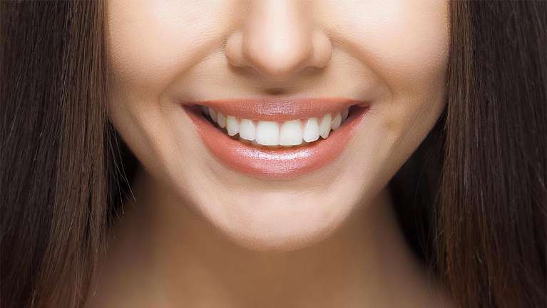 Invisalign in mount pleasant