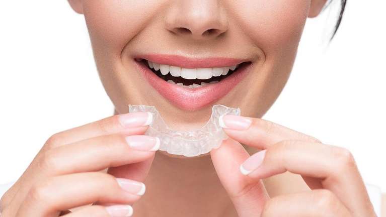 invisalign in mount waverley 